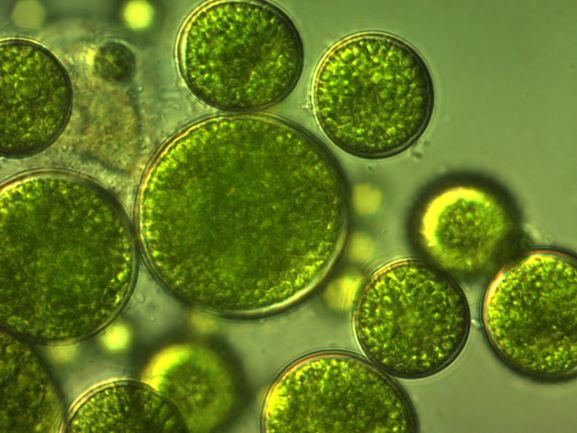 Algae under microscope